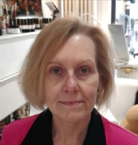 Marco Mannozzi Foto einer Kundin vorher